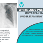 White Lung Pneumonia Outbreak in Ohio: 10 Shocking Facts