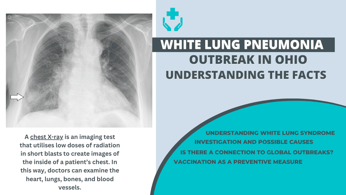 White Lung Pneumonia Outbreak in Ohio 10 Shocking Facts