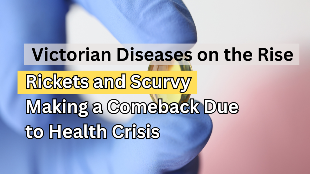 Victorian Diseases On The Rise Rickets And Scurvy Making A Comeback Due To Health Crisis